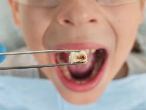Best Pediatric Emergency Dentist in Palmyra, MO